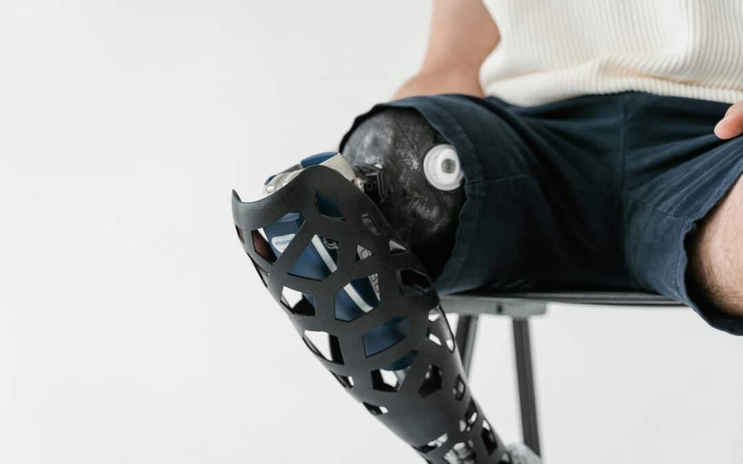 fisioterapia para protese de joelho