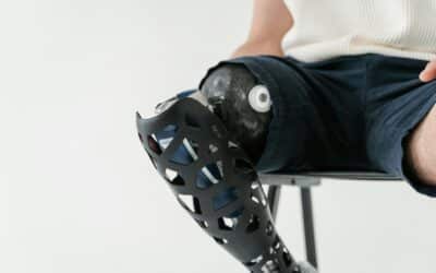 Reabilitação e fisioterapia para prótese de joelho: Ganhando amplitude sem dor